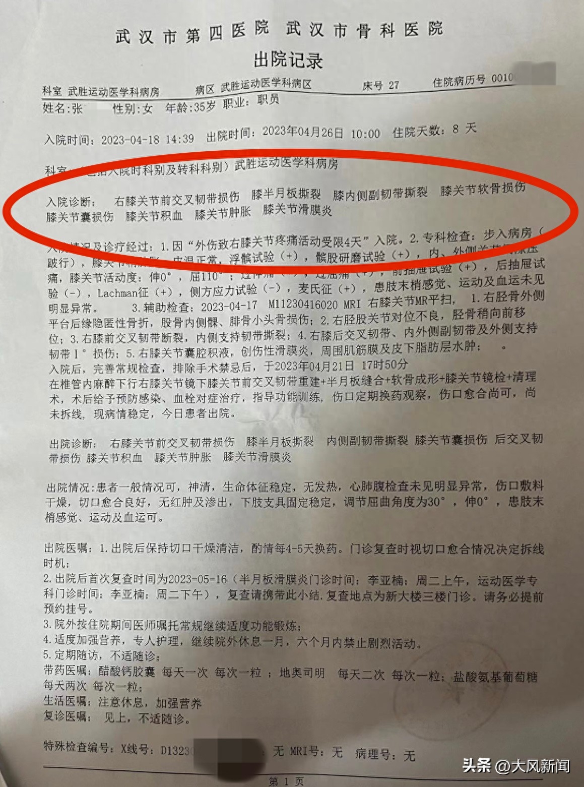 汽车小事故有可能换车门吗_换门算事故车吗_小事故车门是换还是修